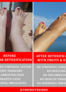 FEET-SWELLING-BEFORE-AND-AFTER-INSTA